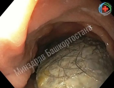 ������ 16-������ �������. ��������� ���������� � ������ � ������