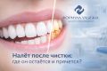 Скрытый налёт на зубах: почему он остаётся даже после чистки и где его искать
