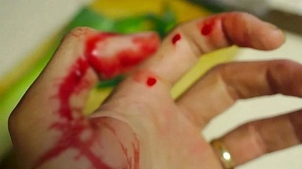 В Благовещенском районе расследуют факт поножовщины